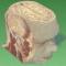 vhp-male-head-sliced